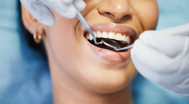 Best Lost Filling or Crown Replacement in Independence, WI